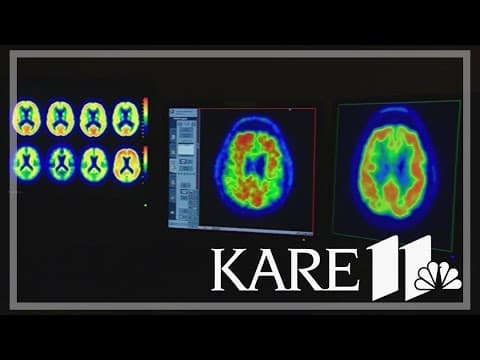Sex, gender mapped in parts of brain