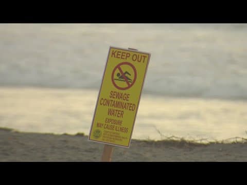 South Bay doctors see unprecedented amount of patients over sewage crisis