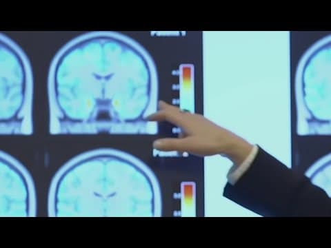 New study shows combination of two simple blood tests can catch 90% of early dementia cases