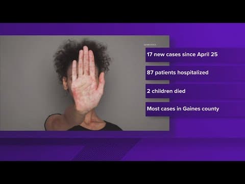 More measles cases reported in Texas: Latest data and everything we know