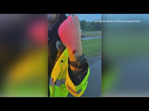 Photos show injuries Louisville cop suffered in Scottie Scheffler arrest