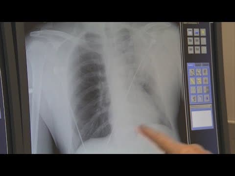 Study shows smoking and vaping carry same risk