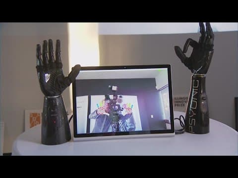 Start up builds prosthetic bionic hand of the future