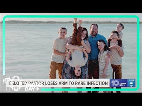 Beloved Polk County pastor loses arm to rare, severe infection