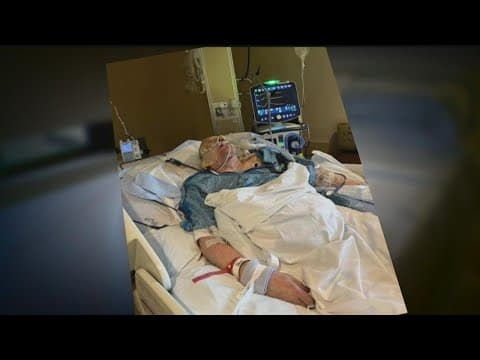 Underinsured: Maple Grove burn survivor shares warning on lack of home insurance