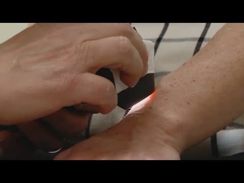 Health: The importance of skin checks