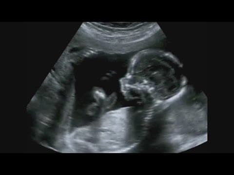 Houston, Texas: Hispanic fertility rates increase dramatically