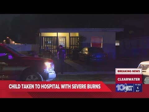 10-year-old boy seriously burned at Clearwater home, officials say