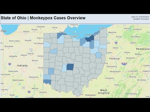 Ohio Department of Health launches monkeypox cases dashboard