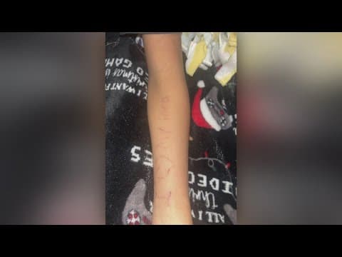 North Texas middle school students gave each other tattoos using the same needle, district says