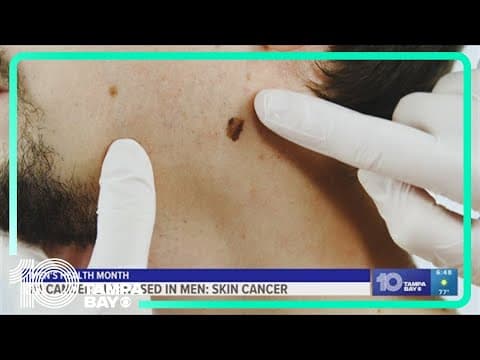 Dermatologist advises men to do their routine checks for skin cancer