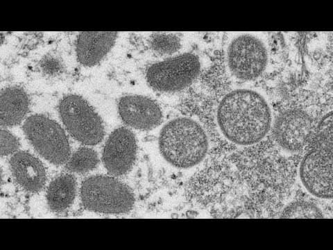 Doctor urge vaccination as number of Mpox cases rise across the country