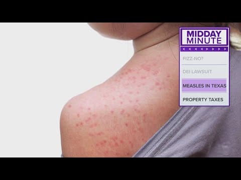 Measles cases reported in Texas