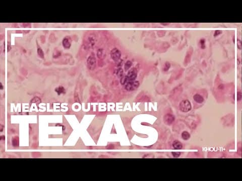 What is your level of measles immunity? There's a way to find out.