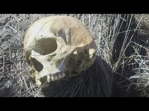 New technology helps identify skull as a Slidell Vietnam veteran