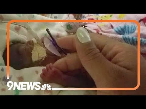 The story of a baby who defied all odds