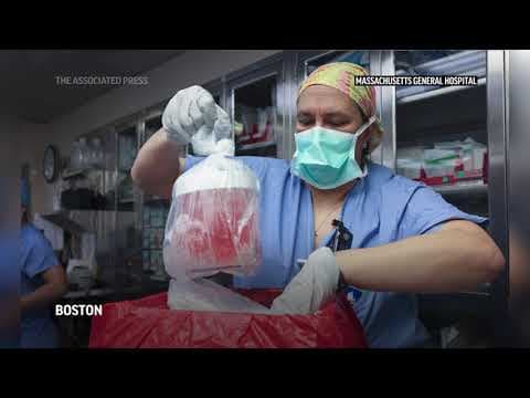 Surgeons transplant a gene-edited pig kidney into a patient for the first time