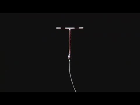 Researchers suggest women using IUDs have a 40% higher risk of breast cancer