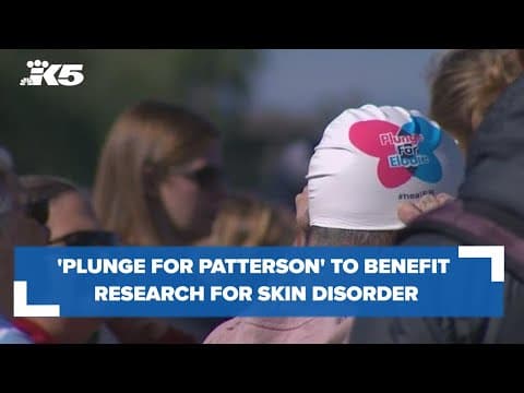 Dozens take the 'Plunge for Patterson' to benefit research for rare skin disorder