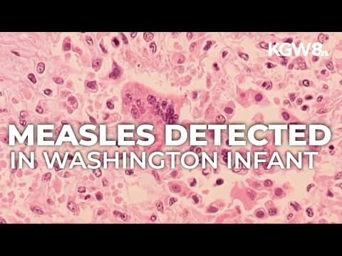 Washington confirms first measles case of the year