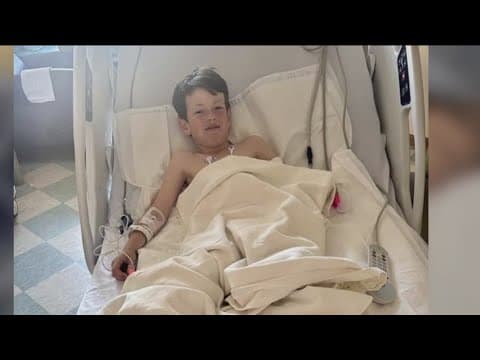 Boy, 9, recovers from rattlesnake bite in North County