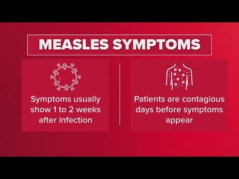 Health officials report first case of measles in Rockwall County