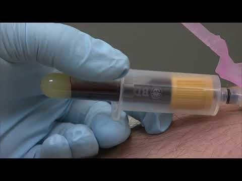 Kidney disease: Why knowing your risk factors is critical