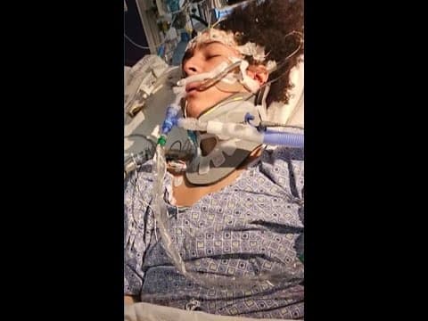Pasco County mother pleads for answers after hit-and-run left son critically injured