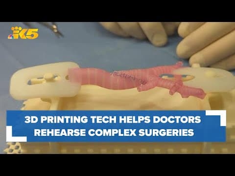 3D printing technology helps surgeons rehearse complex surgeries: HealthLink