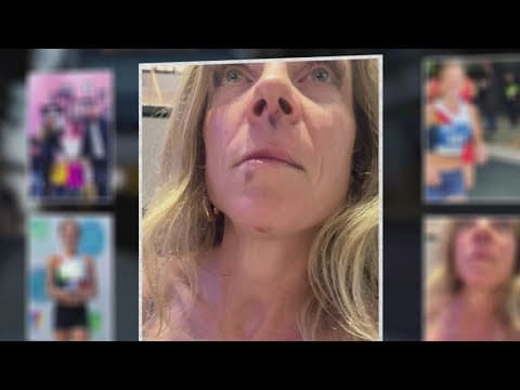 Homeless suspect arrested for attack on Downtown Dallas tourist