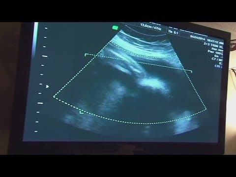 New report claims crisis pregnancy centers in Columbus providing misinformation on abortion, birth c