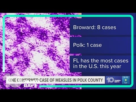 Polk County reports 1 case of measles