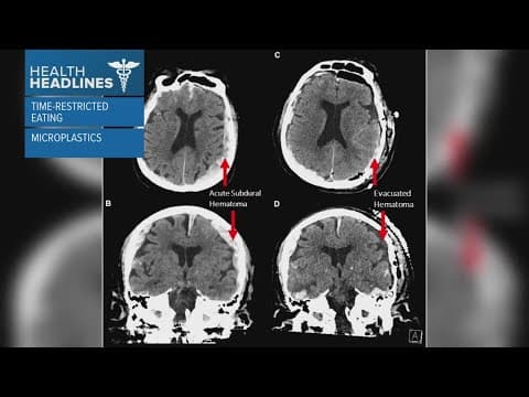 Health Headlines: Time-restricted eating, microplastics and lead in cinnamon