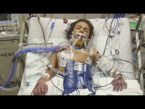 Cardiac arrest cases in young athletes