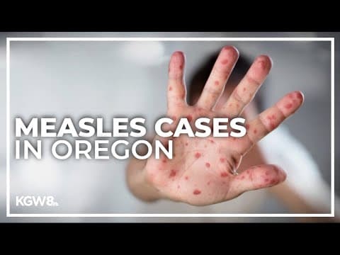 Oregon health officials report 2 cases of measles confirmed in Clackamas County, 1 in Marion County