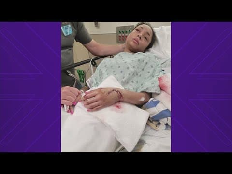 Woman says shark attacked her in Galveston so she punched it