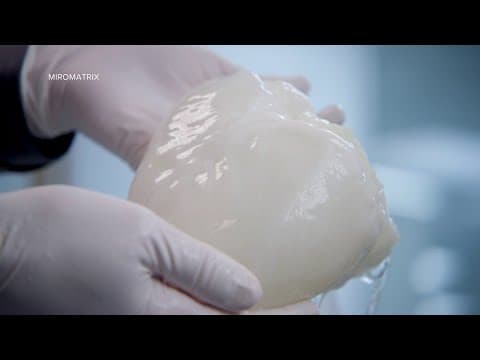 'This will be a first': Eden Prairie company works to revolutionize organ transplants