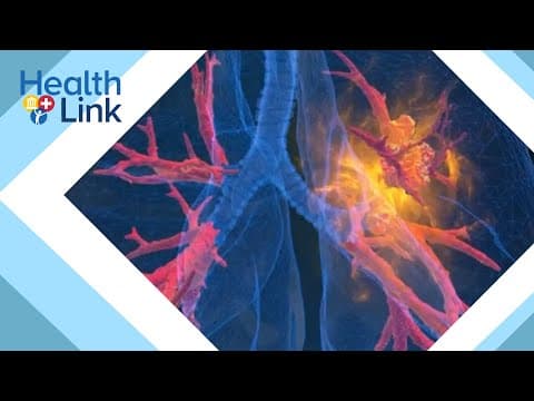 Research shows higher rates of younger women diagnosed with lung cancer than younger men: HealthLink