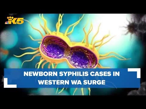 Newborn syphilis cases in western Washington surge, reflecting nationwide trend: HealthLink