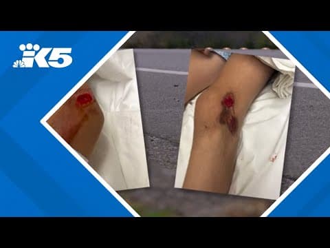 'It's infuriating': Mother of boy hit by car while riding bike pleading for help to find suspects