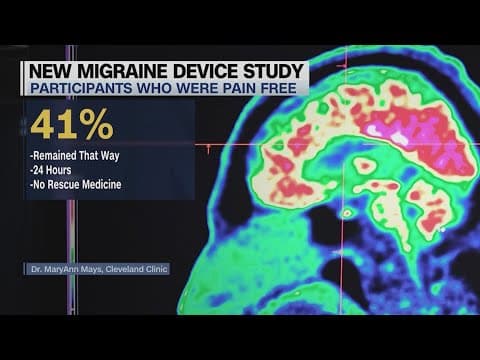 New drug-free device could help combat migraines