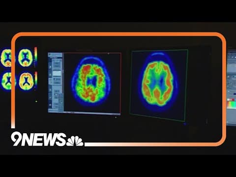 New blood test can help diagnose Alzheimer's disease