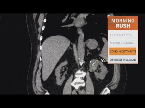 COVID-19 is no longer one of the top ten causes of death in the US