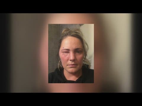 Danger of fireworks & How to avoid injury