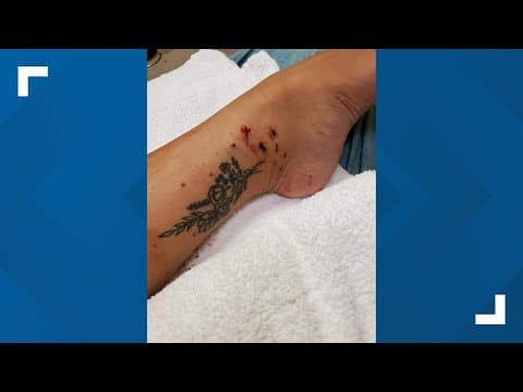 Columbus woman attacked by shark in Florida