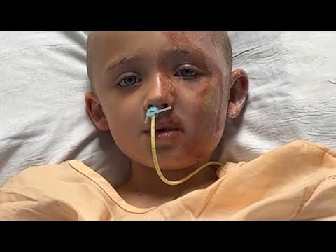 6-year-old boy, grandmother severely burned by downed power line recovering in hospital