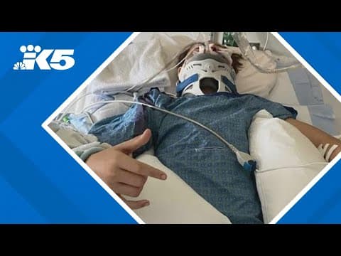 Auburn teenager recovering after being shot three times