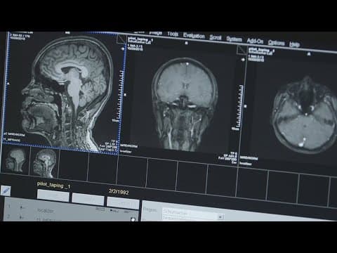 New research shows one common gesture could be a signal of a concussion