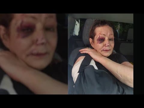 Fort Worth PD is investigating an officer after woman was hospitalized in use-of-force incident