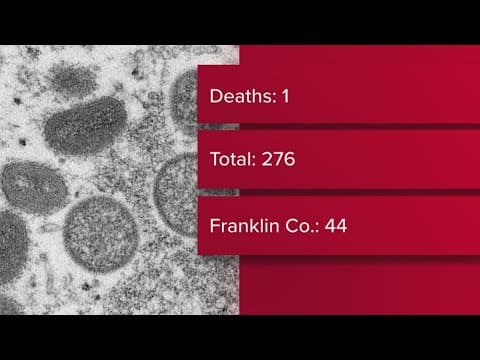 Ohio reports first death associated with monkeypox